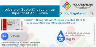 Labetolol (Lablol®) Uygulama Akıl Kartı