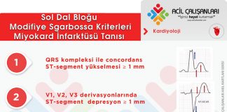 Modifiye Sgarbossa Kriterleri Akıl Kartı