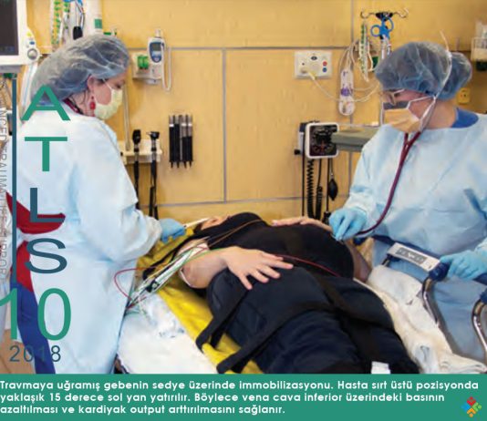 Aortokaval Kompresyon Sendromu