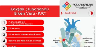 Prematüre Kavşak (Junctional) Atım (PJC)