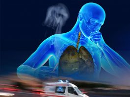 KOAH Hastalarına Hastane Öncesi Yaklaşım