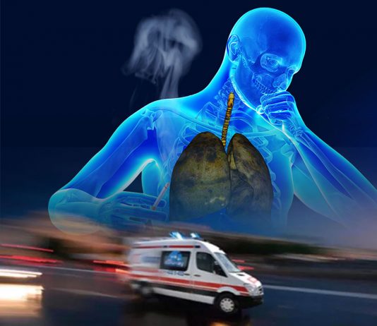 KOAH Hastalarına Hastane Öncesi Yaklaşım