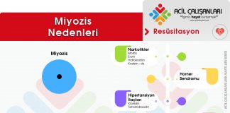 Miyozis Nedenleri Akıl Kartı