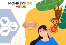 Maymun Çiçeği Hastalığı Acil Yaklaşım