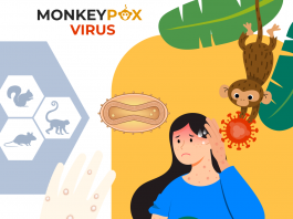 Maymun Çiçeği Hastalığı Acil Yaklaşım