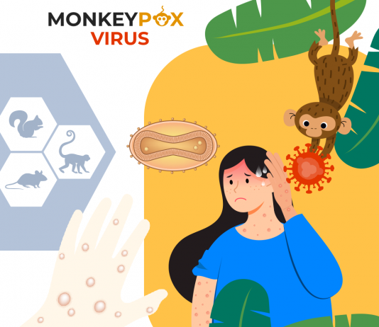 Maymun Çiçeği Hastalığı Acil Yaklaşım