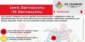 Lewis Derivasyonu (S5 Derivasyonu)