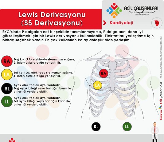 Lewis Derivasyonu (S5 Derivasyonu)