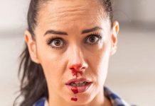 Epistaksis (Burun Kanaması) Yönetimi