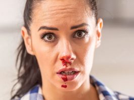 Epistaksis (Burun Kanaması) Yönetimi