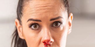 Epistaksis (Burun Kanaması) Yönetimi