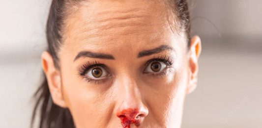 Epistaksis (Burun Kanaması) Yönetimi