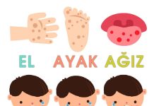 El Ayak Ağız Hastalığı