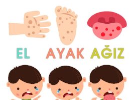 El Ayak Ağız Hastalığı