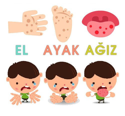 El Ayak Ağız Hastalığı
