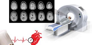 Hipertansif Ensefalopati Acil Yaklaşım