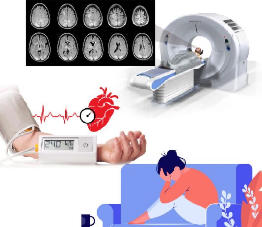 Hipertansif Ensefalopati Acil Yaklaşım