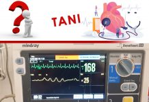 50 Yaş Erkek Hasta Çarpıntı Şikayeti SVT Olgu Sunumu