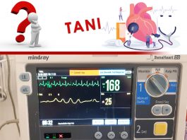 50 Yaş Erkek Hasta Çarpıntı Şikayeti SVT Olgu Sunumu