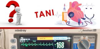 50 Yaş Erkek Hasta Çarpıntı Şikayeti SVT Olgu Sunumu