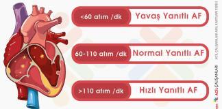 Yavaş Ventrikül Yanıtlı Atrial Fibrilasyon Acil Yaklaşım
