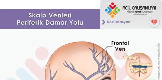 Kafa Derisi Ven Kateterizasyonu