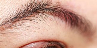 Blefarit Acil Yaklaşım