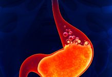 Gastrit Acil Yaklaşım