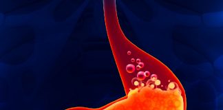 Gastrit Acil Yaklaşım