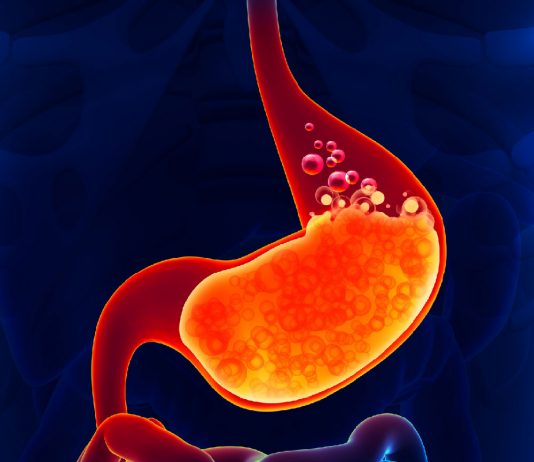 Gastrit Acil Yaklaşım