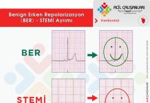 Benign Erken Repolarizasyon