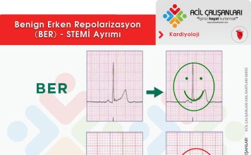 Benign Erken Repolarizasyon