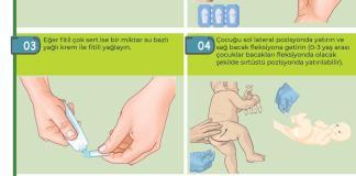 Rektal Supozituvar (Fitil) İlaç Uygulama