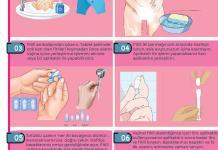 Vajinal Supozituvar (Fitil) İlaç Uygulama