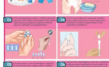 Vajinal Supozituvar (Fitil) İlaç Uygulama