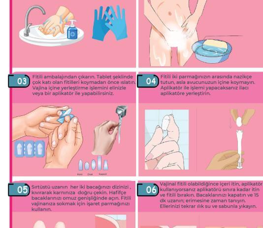 Vajinal Supozituvar (Fitil) İlaç Uygulama