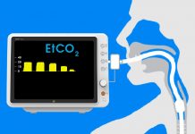 Olgularla Kapnografi