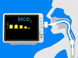 Olgularla Kapnografi