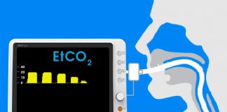 Olgularla Kapnografi