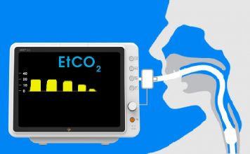 Olgularla Kapnografi