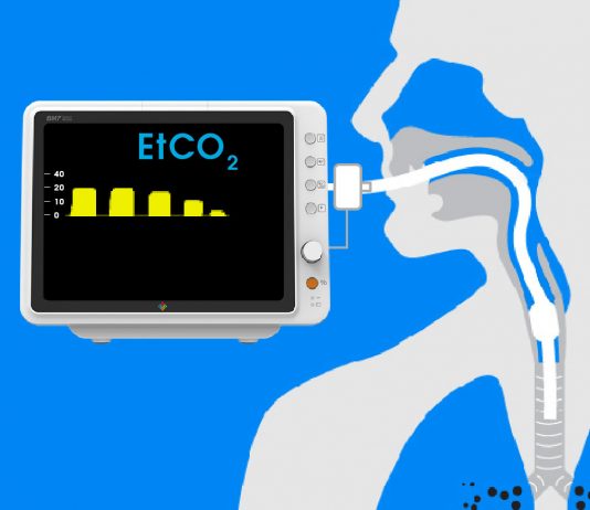 Olgularla Kapnografi