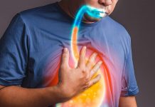 Gastroözofageal Reflü (GÖR) Acil Yaklaşım