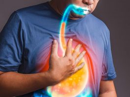 Gastroözofageal Reflü (GÖR) Acil Yaklaşım