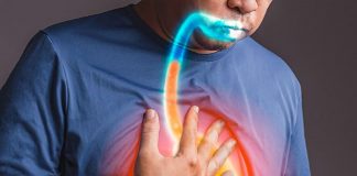 Gastroözofageal Reflü (GÖR) Acil Yaklaşım