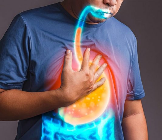 Gastroözofageal Reflü (GÖR) Acil Yaklaşım