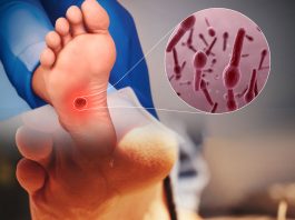 Tetanoz Hastalığına Acil Servis Yaklaşımı