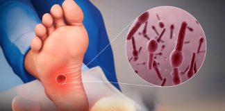 Tetanoz Hastalığına Acil Servis Yaklaşımı