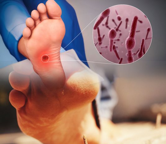 Tetanoz Hastalığına Acil Servis Yaklaşımı