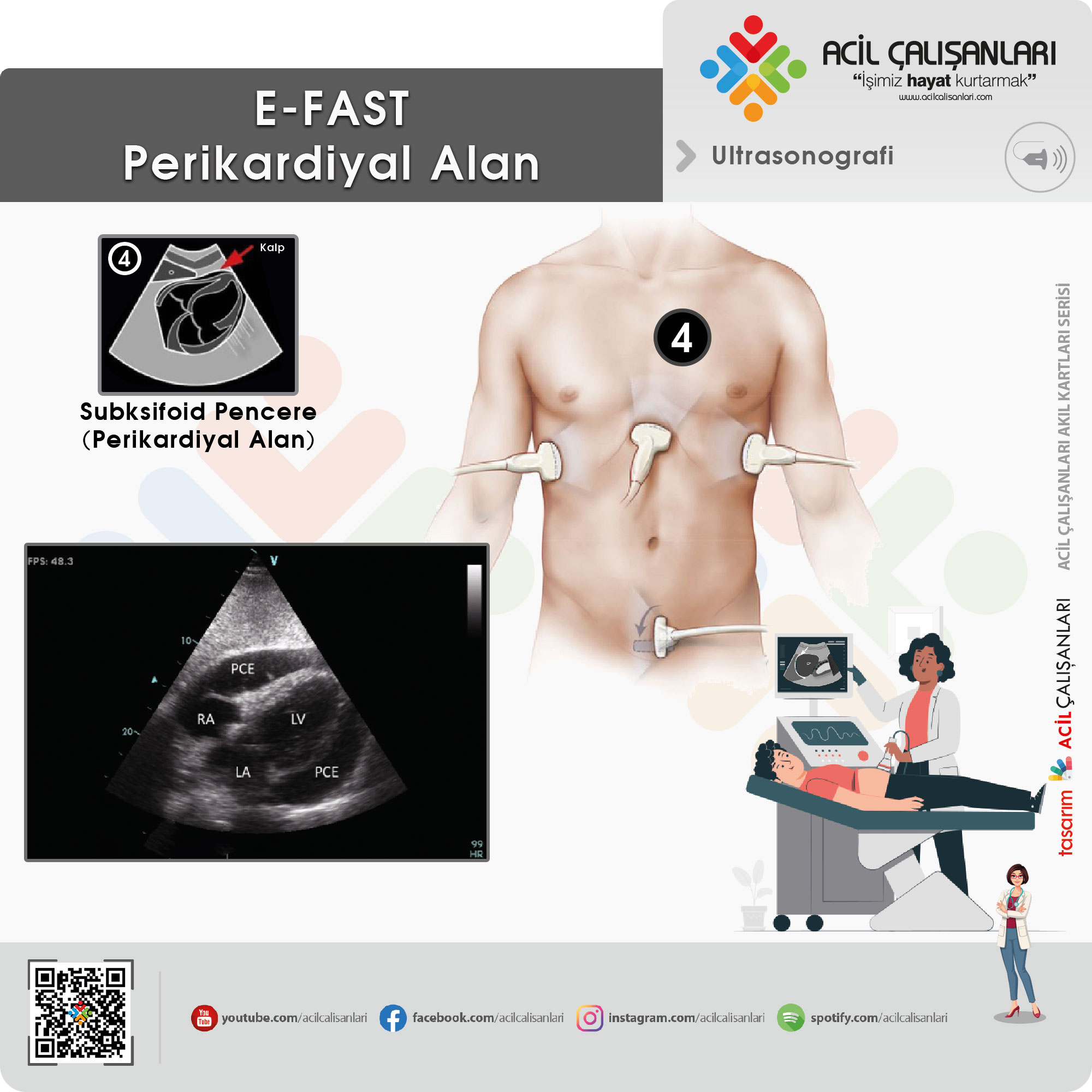 FAST / E-FAST Protokolü - Acil Çalışanları