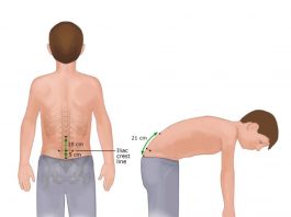 Modifiye Schober Testi